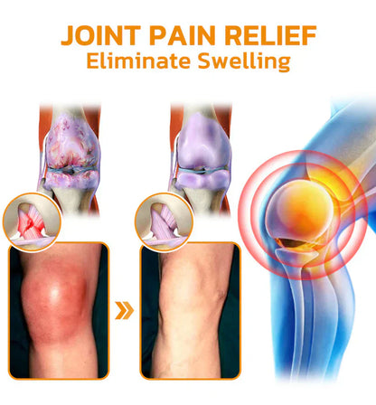 LOVILDS™ Bee poison  Pain-Relief Bone Healing Cream👨‍⚕️British Orthopaedic Association  (BOA) Approved