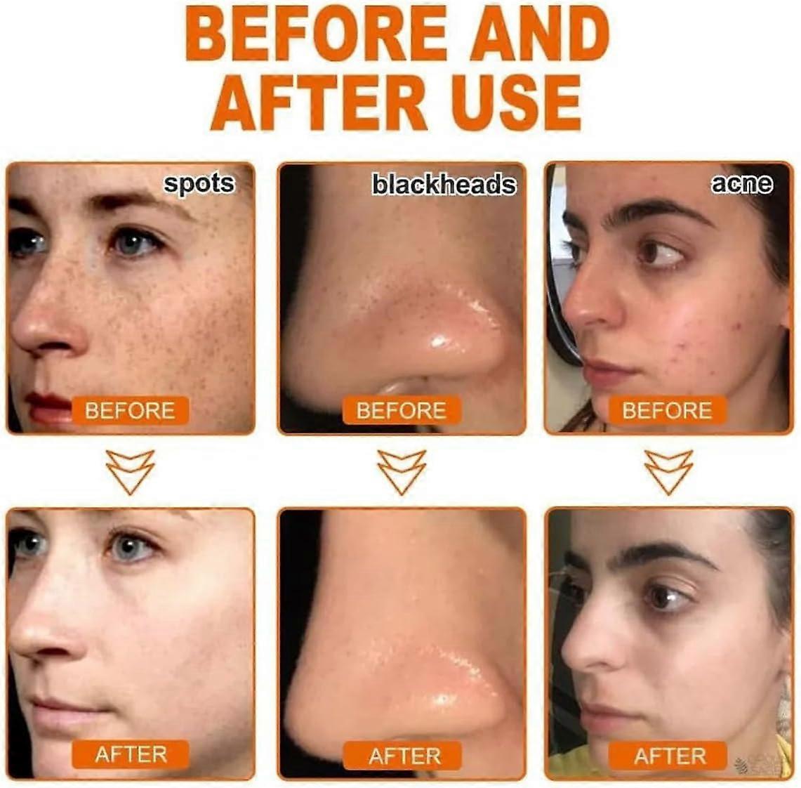 AQA™ Whitening and Freckle - Removing Mask