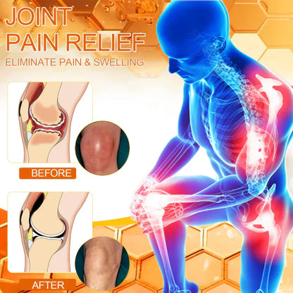LOVILDS™ Bee poison  Pain-Relief Bone Healing Cream👨‍⚕️British Orthopaedic Association  (BOA) Approved