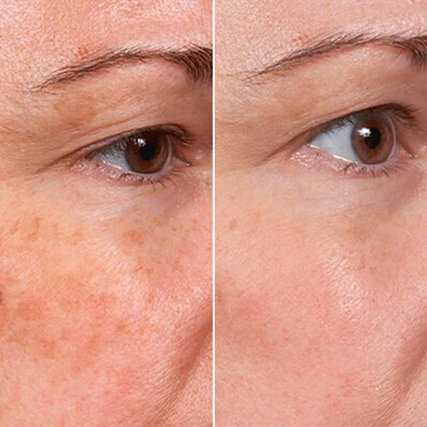 Jaxvolt™ Rejuvenate Face Serum