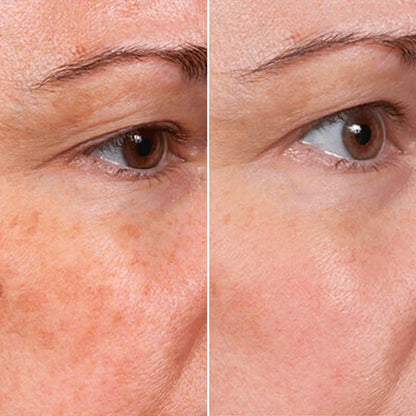 Jaxvolt™ Rejuvenate Face Serum