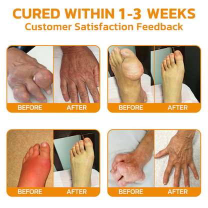 LOVILDS™ Bee poison  Pain-Relief Bone Healing Cream👨‍⚕️British Orthopaedic Association  (BOA) Approved