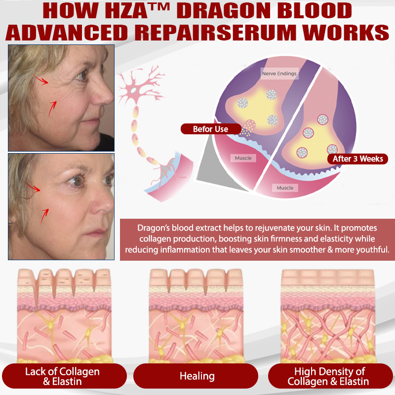 HZA™ Dragon Blood Advanced RepairSerum