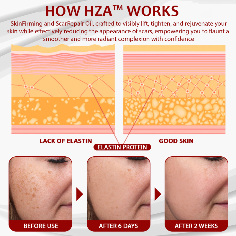 HZA™ Dragon Blood Advanced RepairSerum