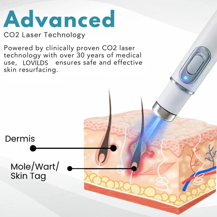 🔥【OFFICIAL STORE】LOVILDS®  Non-Invasive Mole and Wart Removal Laser Pen