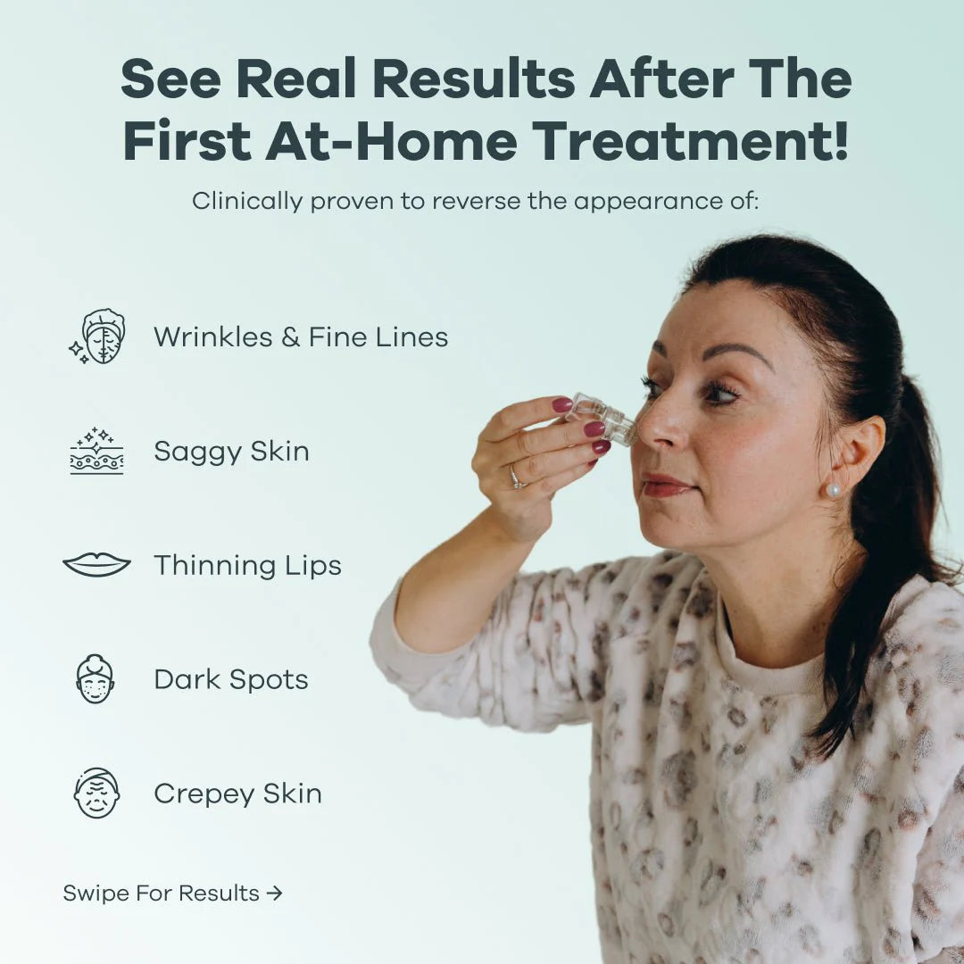 Cougex™ The Micro needling Infusion System