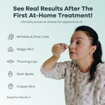 Cougex™ The Micro needling Infusion System